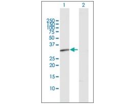 Anti-RDH12 antibody produced in rabbitpurified immunoglobulin, buffered aqueous solution