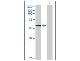 Anti-CYP3A7 antibody produced in rabbitpurified immunoglobulin, buffered aqueous solution