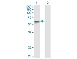 Anti-CYP27A1 antibody produced in rabbitpurified immunoglobulin, buffered aqueous solution
