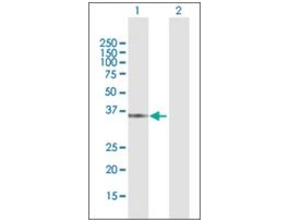 Anti-QPRT antibody produced in rabbitpurified immunoglobulin, buffered aqueous solution