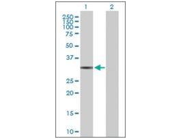 Anti-QPRT antibody produced in rabbitpurified immunoglobulin, buffered aqueous solution