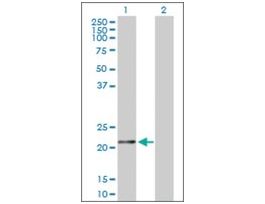 Anti-FTH1 antibody produced in rabbitpurified immunoglobulin, buffered aqueous solution