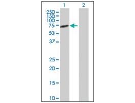 Anti-ALPPL2 antibody produced in rabbitpurified immunoglobulin, buffered aqueous solution