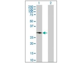 Anti-GCH1 antibody produced in rabbitpurified immunoglobulin, buffered aqueous solution