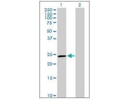 Anti-GSTM5 antibody produced in rabbitpurified immunoglobulin, buffered aqueous solution