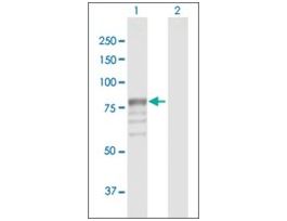 Anti-GUSB antibody produced in rabbitpurified immunoglobulin, buffered aqueous solution