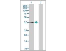 Anti-CFHR1 antibody produced in rabbitpurified immunoglobulin, buffered aqueous solution