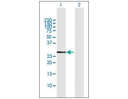 Anti-CYB5R1 antibody produced in rabbitpurified immunoglobulin, buffered aqueous solution