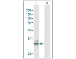Anti-PPT1 antibody produced in rabbitpurified immunoglobulin, buffered aqueous solution