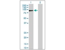 Anti-RAD18 antibody produced in rabbitpurified immunoglobulin, buffered aqueous solution