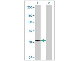 Anti-PTGIS antibody produced in rabbitpurified immunoglobulin, buffered aqueous solution