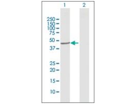 Anti-CYP20A1 antibody produced in rabbitpurified immunoglobulin, buffered aqueous solution