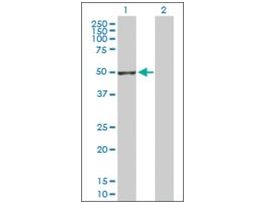 Anti-GSDMDC1 antibody produced in rabbitpurified immunoglobulin, buffered aqueous solution