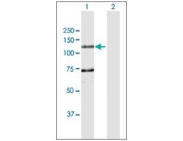 Anti-DDHD1 antibody produced in rabbitpurified immunoglobulin, buffered aqueous solution