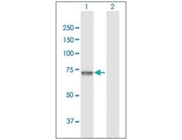 Anti-GNPAT antibody produced in rabbitpurified immunoglobulin, buffered aqueous solution