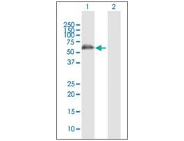 Anti-ALDH4A1 antibody produced in rabbitpurified immunoglobulin, buffered aqueous solution