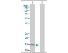 Anti-PTGES antibody produced in rabbitpurified immunoglobulin, buffered aqueous solution