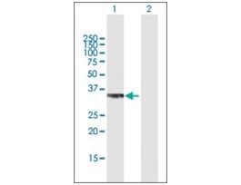 Anti-PPP2CB antibody produced in mousepurified immunoglobulin, buffered aqueous solution