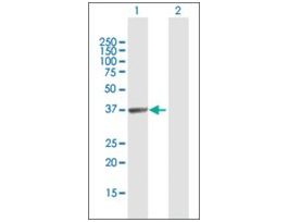 Anti-HABP4 antibody produced in rabbitpurified immunoglobulin, buffered aqueous solution
