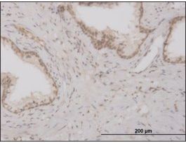 ANTI-FOXO3A antibody produced in mouseclone 2H2, purified immunoglobulin, buffered aqueous solution