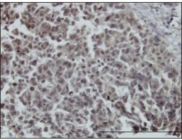 ANTI-FOXO3A antibody produced in mouseclone 4E8, purified immunoglobulin, buffered aqueous solution