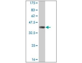 ANTI-FOXO3A antibody produced in mouseclone 4F2, purified immunoglobulin, buffered aqueous solution