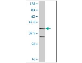 ANTI-FOXO1A antibody produced in mouseclone 4A3, purified immunoglobulin, buffered aqueous solution