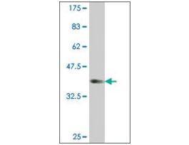 ANTI-PTCH antibody produced in mouseclone 3B3, purified immunoglobulin, buffered aqueous solution
