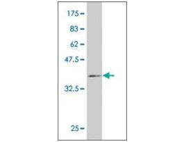 ANTI-HD antibody produced in mouseclone 1A12, purified immunoglobulin, buffered aqueous solution