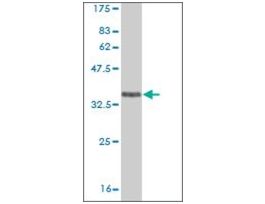 ANTI-EPHA5 antibody produced in mouseclone 5C8, purified immunoglobulin, buffered aqueous solution