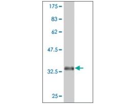 ANTI-EPHA5 antibody produced in mouseclone 6F4, purified immunoglobulin, buffered aqueous solution
