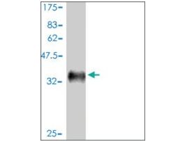 ANTI-EPHB2 antibody produced in mouseclone 1F10, ascites fluid, buffered aqueous solution