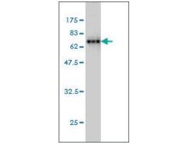 ANTI-AHCY antibody produced in mouseclone M2, purified immunoglobulin, buffered aqueous solution