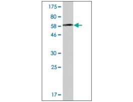 ANTI-AHCY antibody produced in mouseclone 2F11-1D10, ascites fluid, buffered aqueous solution
