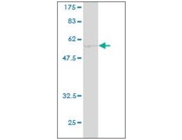 ANTI-CA1 antibody produced in mouseclone 1E11, purified immunoglobulin, buffered aqueous solution