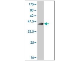 ANTI-RARA antibody produced in mouseclone 4B3, purified immunoglobulin, buffered aqueous solution