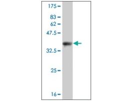 ANTI-PUM2 antibody produced in mouseclone 3E6, purified immunoglobulin, buffered aqueous solution