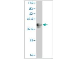 ANTI-PUM2 antibody produced in mouseclone 4G12, purified immunoglobulin, buffered aqueous solution