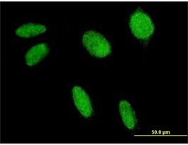 ANTI-FLI1 antibody produced in mouseclone 2F3, purified immunoglobulin, buffered aqueous solution