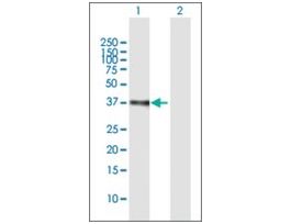 ANTI-ETV2 antibody produced in mousepurified immunoglobulin, buffered aqueous solution