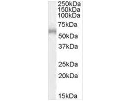 Anti-ADRB1 antibody produced in goataffinity isolated antibody, buffered aqueous solution
