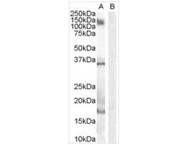 Anti-AIF1/IBA1 (Isoform 3) antibody produced in goataffinity isolated antibody, buffered aqueous solution