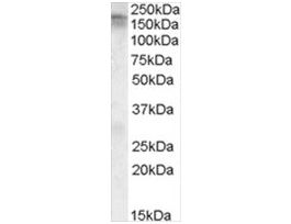 Anti-CACNA1C antibody produced in goataffinity isolated antibody, buffered aqueous solution