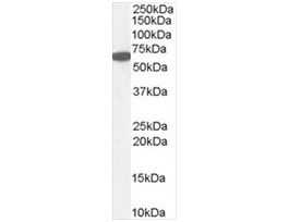 Anti-Catalase/CAT antibody produced in goataffinity isolated antibody, buffered aqueous solution