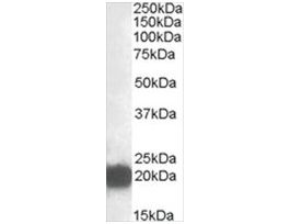 Anti-CSRP3 antibody produced in goataffinity isolated antibody, buffered aqueous solution