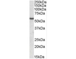 Anti-Desmin antibody produced in goataffinity isolated antibody, buffered aqueous solution
