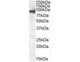 Anti-EWS/EWSR1 antibody produced in goataffinity isolated antibody, buffered aqueous solution