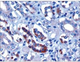 Anti-FBXW2 antibody produced in goataffinity isolated antibody, buffered aqueous solution