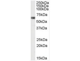 Anti-FOXO4/MLLT7 antibody produced in goataffinity isolated antibody, buffered aqueous solution