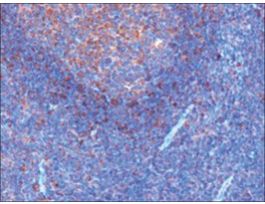 Anti-GRB2 antibody produced in goataffinity isolated antibody, buffered aqueous solution